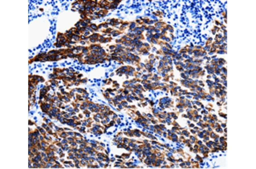 Immunohistochemistry - KRT6A Antibody from Signalway Antibody (35628) - Antibodies.com