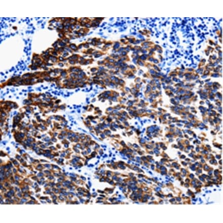 Immunohistochemistry - KRT6A Antibody from Signalway Antibody (35628) - Antibodies.com