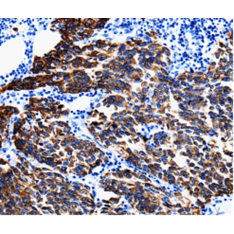 Immunohistochemistry - KRT6A Antibody from Signalway Antibody (35628) - Antibodies.com