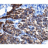 Immunohistochemistry - KRT6A Antibody from Signalway Antibody (35628) - Antibodies.com