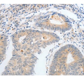 Immunohistochemistry - CALCR Antibody from Signalway Antibody (35633) - Antibodies.com