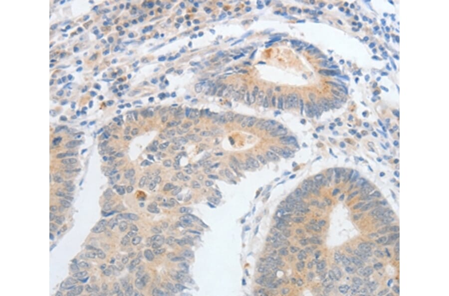 Immunohistochemistry - CALCR Antibody from Signalway Antibody (35633) - Antibodies.com
