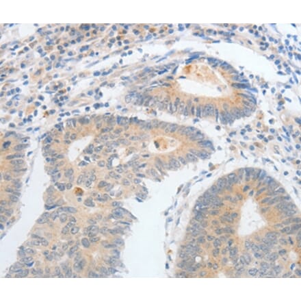 Immunohistochemistry - CALCR Antibody from Signalway Antibody (35633) - Antibodies.com