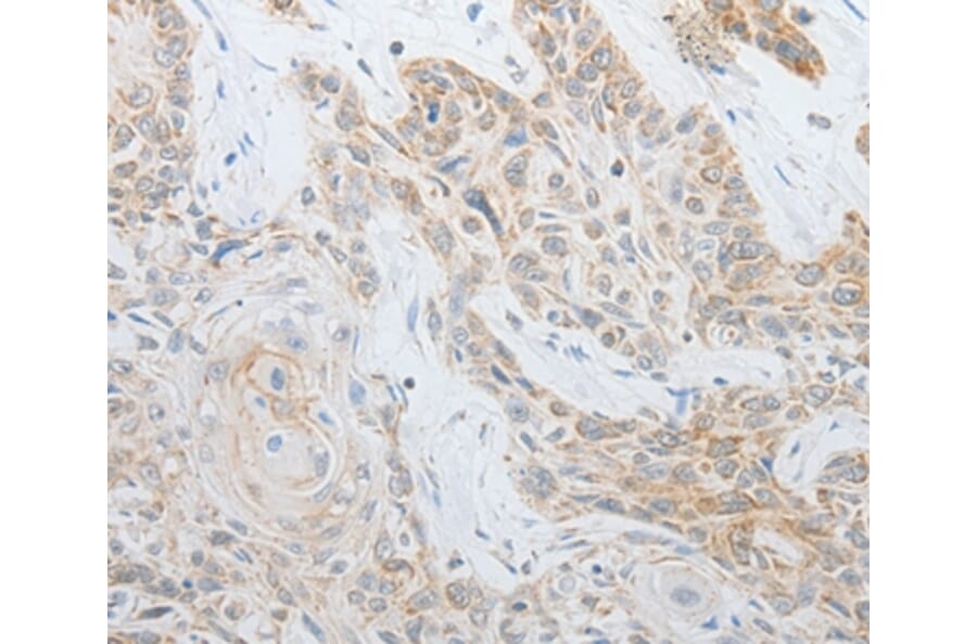 Immunohistochemistry - CALCR Antibody from Signalway Antibody (35633) - Antibodies.com