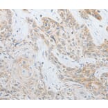 Immunohistochemistry - CALCR Antibody from Signalway Antibody (35633) - Antibodies.com