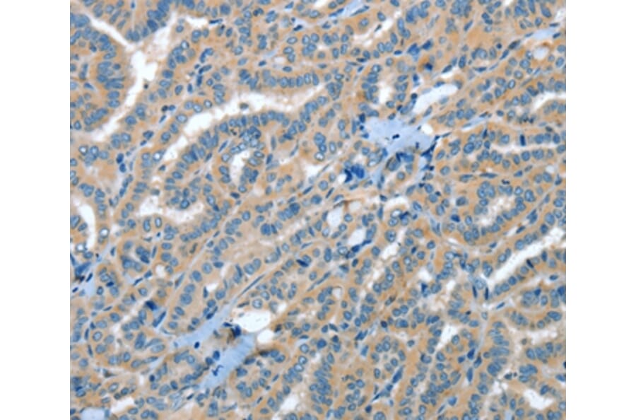 Immunohistochemistry - RAP1A Antibody from Signalway Antibody (35640) - Antibodies.com