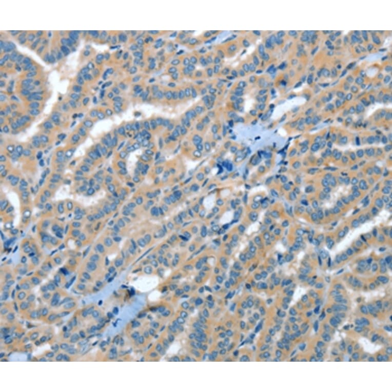 Immunohistochemistry - RAP1A Antibody from Signalway Antibody (35640) - Antibodies.com