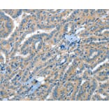Immunohistochemistry - RAP1A Antibody from Signalway Antibody (35640) - Antibodies.com