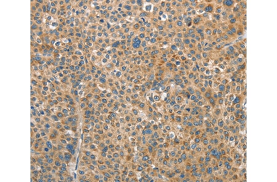 Immunohistochemistry - RAP1A Antibody from Signalway Antibody (35640) - Antibodies.com