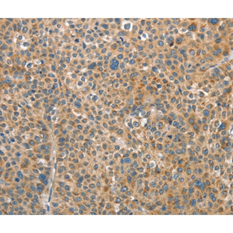 Immunohistochemistry - RAP1A Antibody from Signalway Antibody (35640) - Antibodies.com