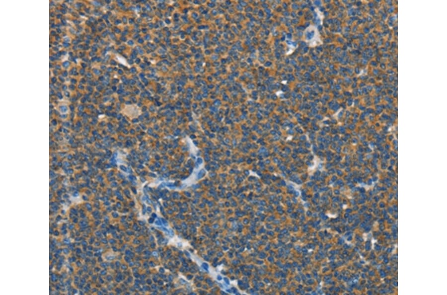Immunohistochemistry - SEPT9 Antibody from Signalway Antibody (35642) - Antibodies.com