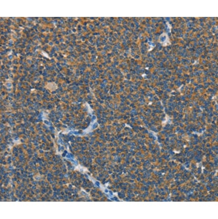 Immunohistochemistry - SEPT9 Antibody from Signalway Antibody (35642) - Antibodies.com