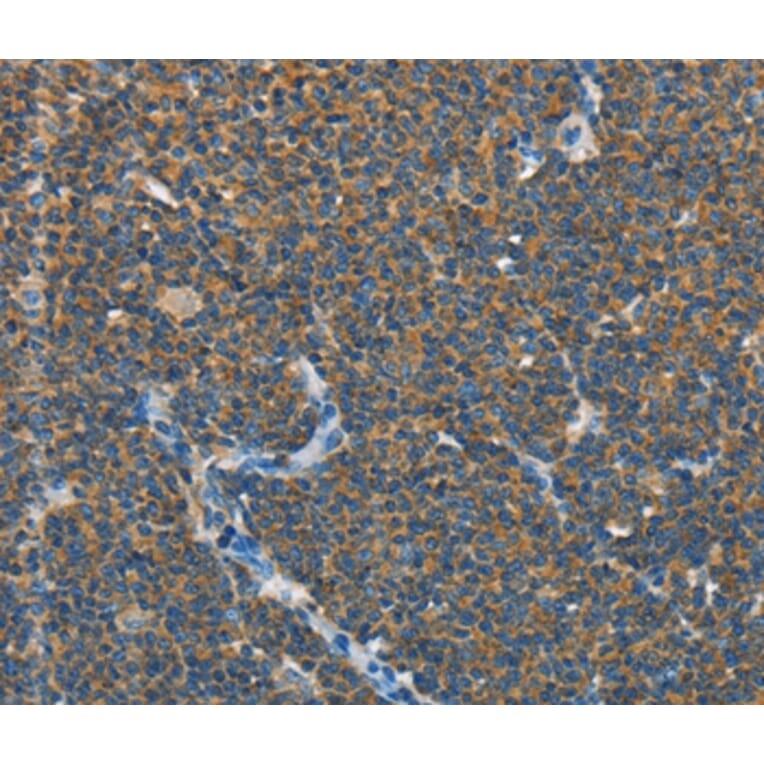 Immunohistochemistry - SEPT9 Antibody from Signalway Antibody (35642) - Antibodies.com