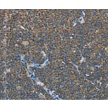 Immunohistochemistry - SEPT9 Antibody from Signalway Antibody (35642) - Antibodies.com