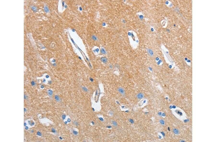 Immunohistochemistry - SEPT9 Antibody from Signalway Antibody (35642) - Antibodies.com