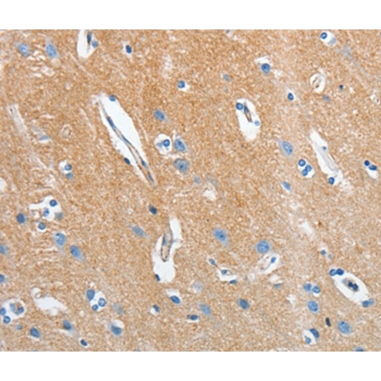 Immunohistochemistry - SEPT9 Antibody from Signalway Antibody (35642) - Antibodies.com
