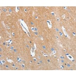 Immunohistochemistry - SEPT9 Antibody from Signalway Antibody (35642) - Antibodies.com