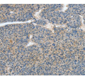 Immunohistochemistry - ATP4B Antibody from Signalway Antibody (35648) - Antibodies.com