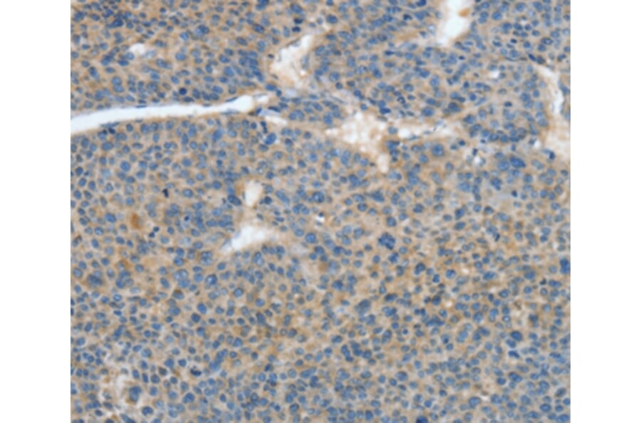 Immunohistochemistry - ATP4B Antibody from Signalway Antibody (35648) - Antibodies.com