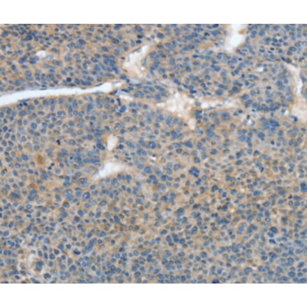 Immunohistochemistry - ATP4B Antibody from Signalway Antibody (35648) - Antibodies.com