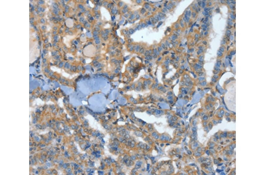 Immunohistochemistry - ATP4B Antibody from Signalway Antibody (35648) - Antibodies.com
