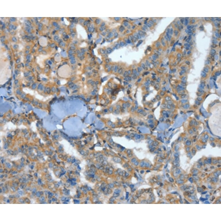 Immunohistochemistry - ATP4B Antibody from Signalway Antibody (35648) - Antibodies.com