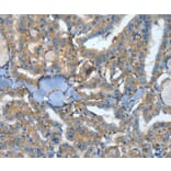 Immunohistochemistry - ATP4B Antibody from Signalway Antibody (35648) - Antibodies.com