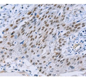 Immunohistochemistry - CAPN6 Antibody from Signalway Antibody (35657) - Antibodies.com