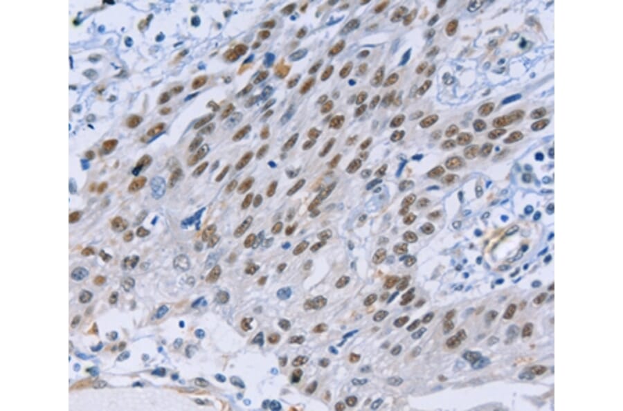 Immunohistochemistry - CAPN6 Antibody from Signalway Antibody (35657) - Antibodies.com