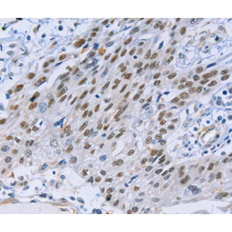 Immunohistochemistry - CAPN6 Antibody from Signalway Antibody (35657) - Antibodies.com