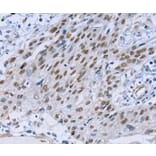 Immunohistochemistry - CAPN6 Antibody from Signalway Antibody (35657) - Antibodies.com