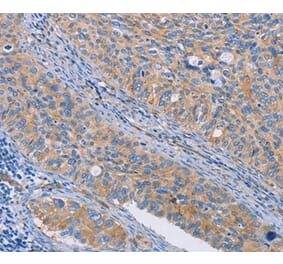 Immunohistochemistry - CAPN7 Antibody from Signalway Antibody (35658) - Antibodies.com