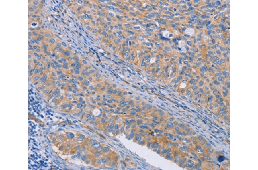 Immunohistochemistry - CAPN7 Antibody from Signalway Antibody (35658) - Antibodies.com