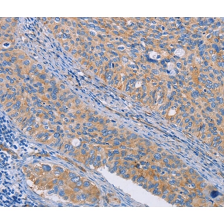 Immunohistochemistry - CAPN7 Antibody from Signalway Antibody (35658) - Antibodies.com