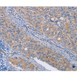Immunohistochemistry - CAPN7 Antibody from Signalway Antibody (35658) - Antibodies.com