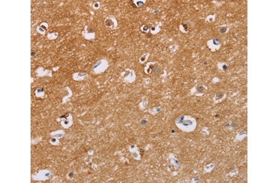 Immunohistochemistry - CAPN7 Antibody from Signalway Antibody (35658) - Antibodies.com