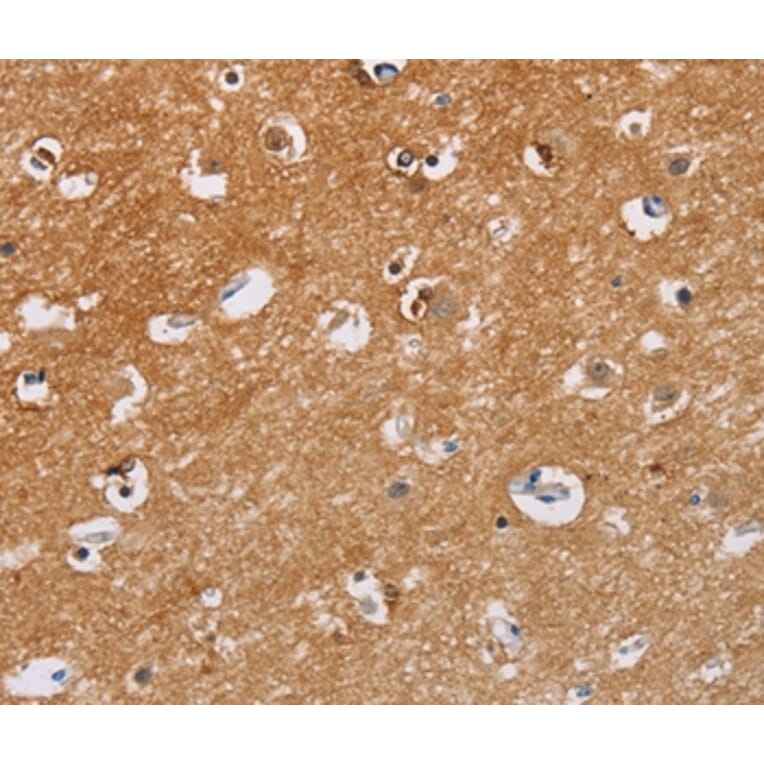 Immunohistochemistry - CAPN7 Antibody from Signalway Antibody (35658) - Antibodies.com