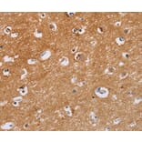 Immunohistochemistry - CAPN7 Antibody from Signalway Antibody (35658) - Antibodies.com