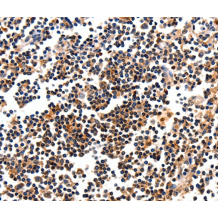 Immunohistochemistry - CAMK1 Antibody from Signalway Antibody (35660) - Antibodies.com