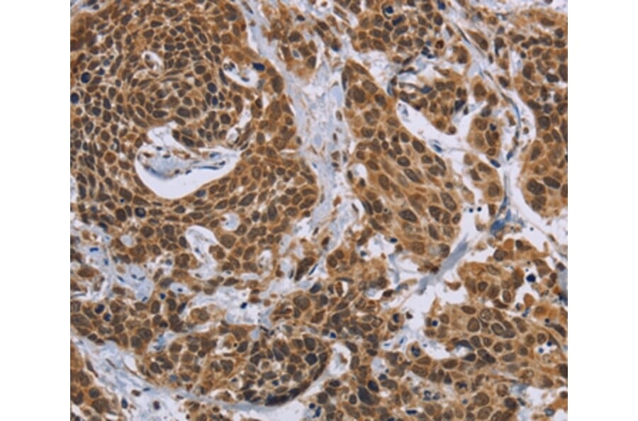 Immunohistochemistry - CCL21 Antibody from Signalway Antibody (35670) - Antibodies.com