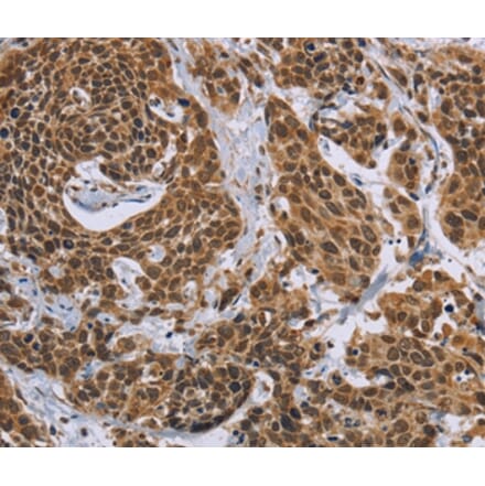 Immunohistochemistry - CCL21 Antibody from Signalway Antibody (35670) - Antibodies.com