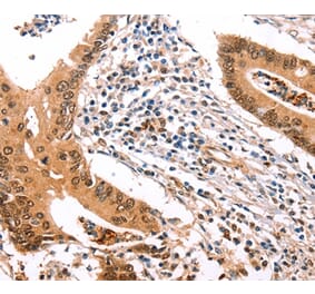 Immunohistochemistry - ERBB3 Antibody from Signalway Antibody (35682) - Antibodies.com