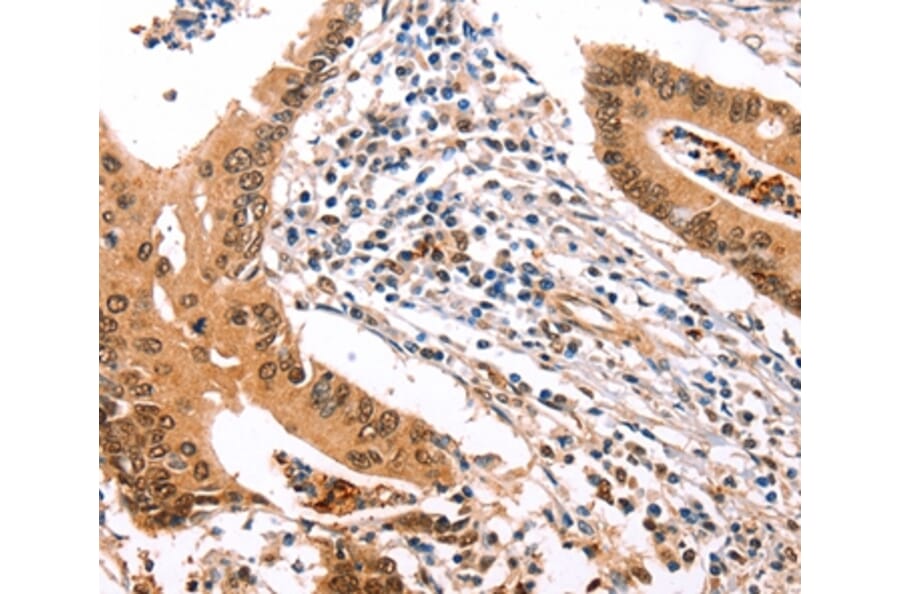 Immunohistochemistry - ERBB3 Antibody from Signalway Antibody (35682) - Antibodies.com