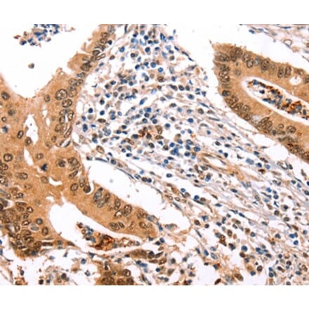 Immunohistochemistry - ERBB3 Antibody from Signalway Antibody (35682) - Antibodies.com