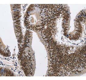 Immunohistochemistry - CMTM2 Antibody from Signalway Antibody (35683) - Antibodies.com