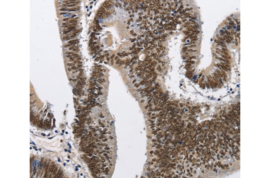 Immunohistochemistry - CMTM2 Antibody from Signalway Antibody (35683) - Antibodies.com