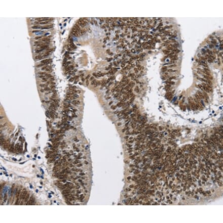 Immunohistochemistry - CMTM2 Antibody from Signalway Antibody (35683) - Antibodies.com