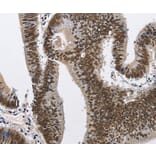 Immunohistochemistry - CMTM2 Antibody from Signalway Antibody (35683) - Antibodies.com