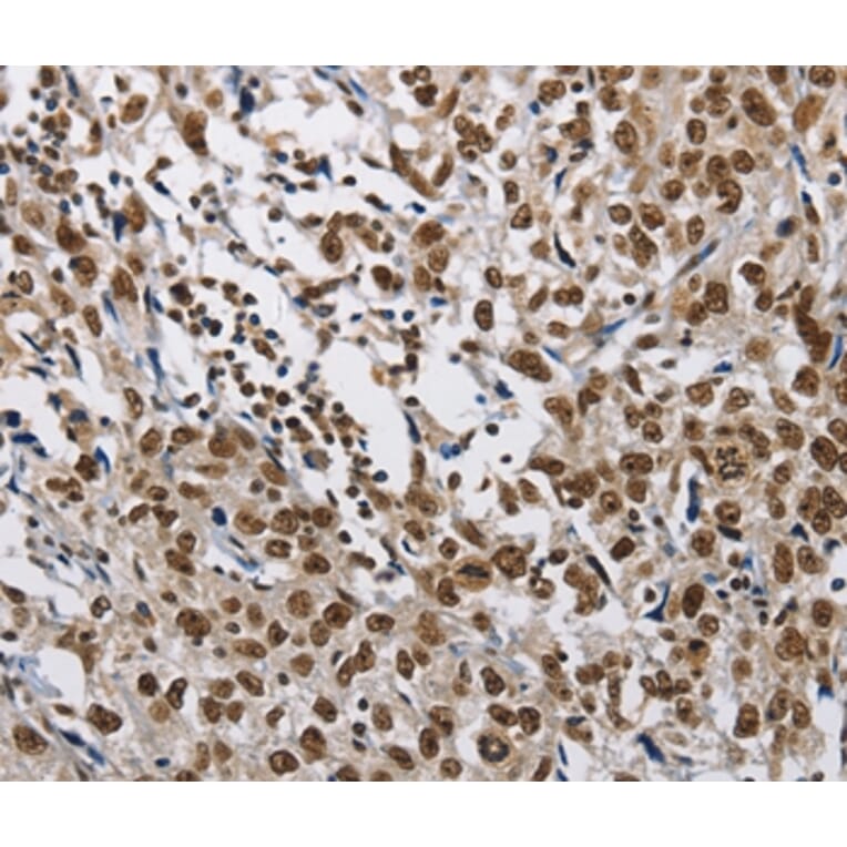 Immunohistochemistry - CMTM2 Antibody from Signalway Antibody (35683) - Antibodies.com