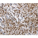 Immunohistochemistry - CMTM2 Antibody from Signalway Antibody (35683) - Antibodies.com